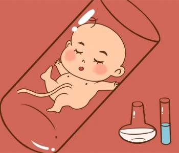 东莞代怀孕都需要做什么检查？孕检nt检查是什么？